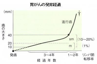 胃がんの発育経過